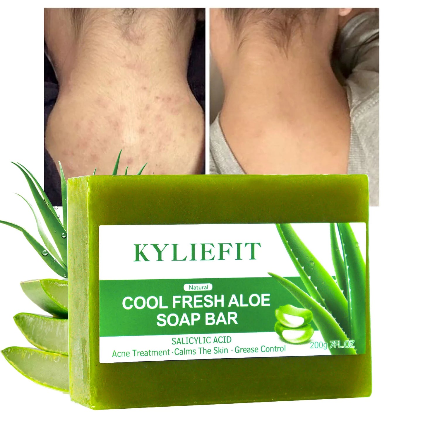 KYLIEFIT Cool Fresh Natural Aloe Vera Soap Bar for All Skin Types, Brightening, Reduce Dark Spots, Acne, Smooth Skin, 200g